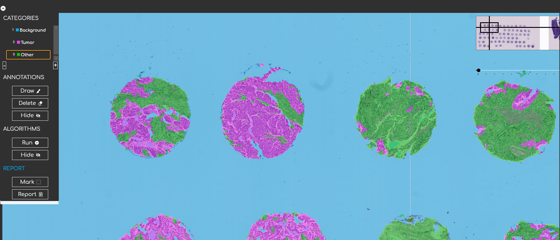 animation test - Deepathology